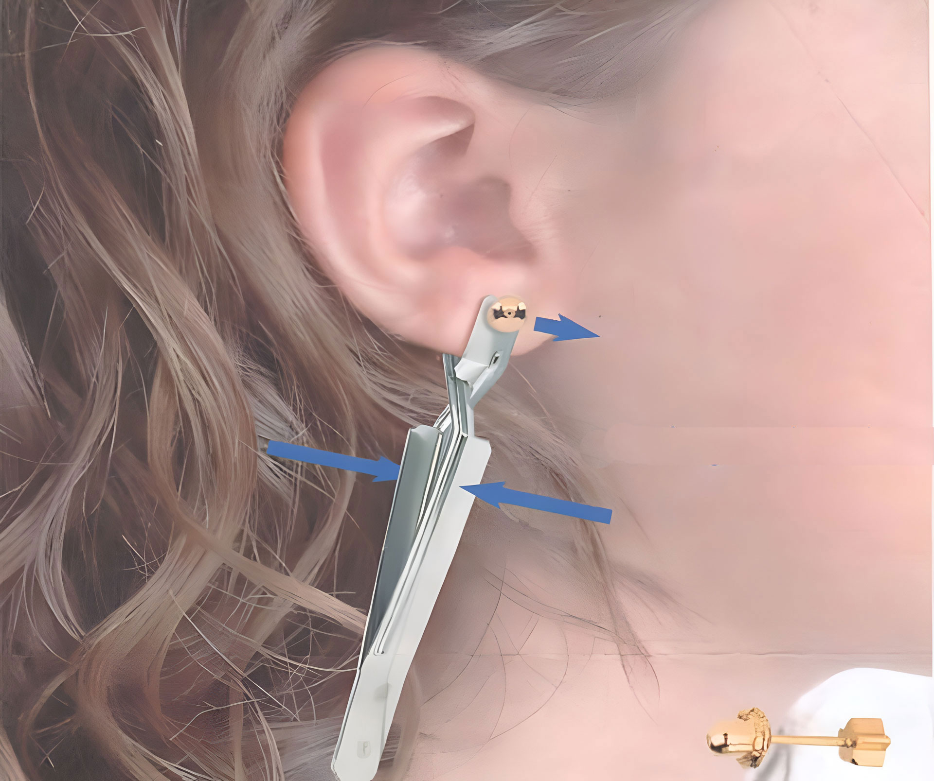 EREX ear ring extractor product presentation